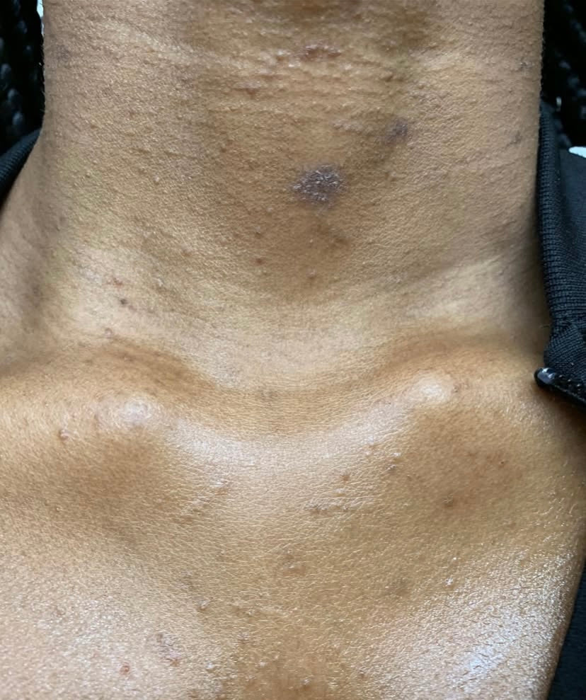 Close-up of dry, patchy skin before using body butter