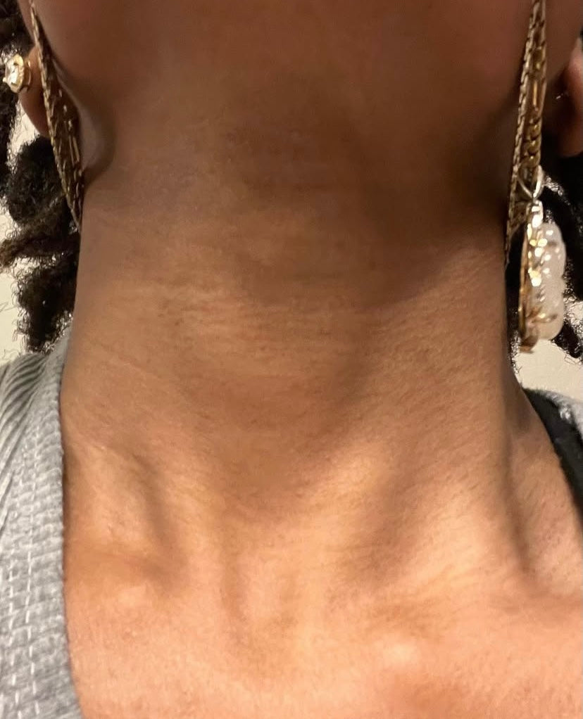 Close-up of smooth, hydrated skin after using body butter