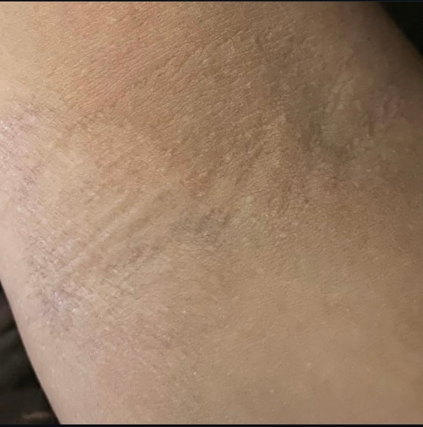 Close up of nourished skin after applying whipped body butter for sensitive skin